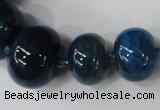 CAG5425 8*12mm – 20*30mm rondelle dragon veins agate beads