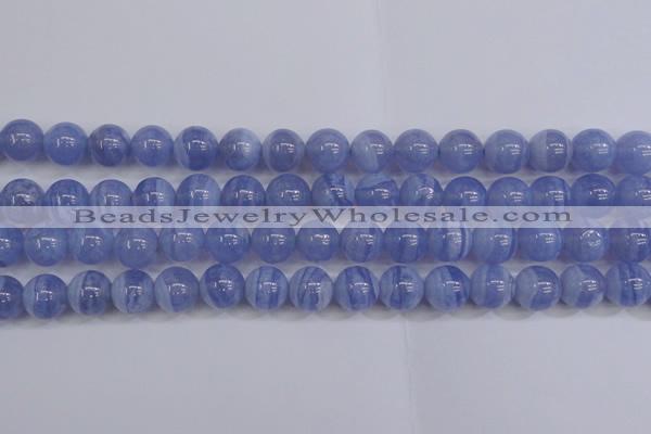 CAG5973 15.5 inches 10mm round blue lace agate beads wholesale