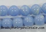 CTU1737 15.5 inches 16mm round synthetic turquoise beads